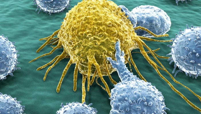 Acute lymphoblastic leukemia
