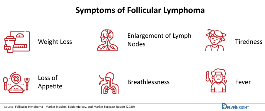 Symptoms-of-Follicular-Lymphoma